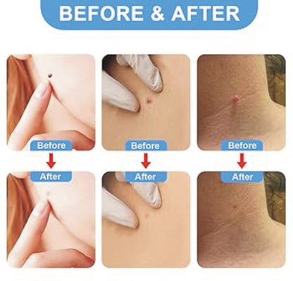 DermaSmooth Patch